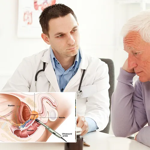 The Comparative Benefits of Penile Implants Explained